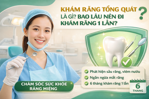Khám Răng Tổng Quát Là Gì? Bao Lâu Nên Đi Khám Răng 1 Lần?
