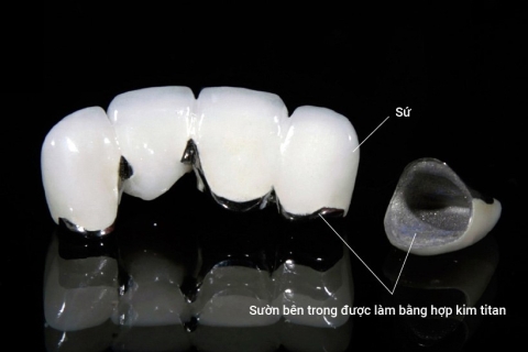 Bọc Răng Sứ Thẩm Mỹ ZIRCONIA ( 20 Răng Trước )