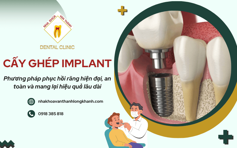 cấy ghép Implant