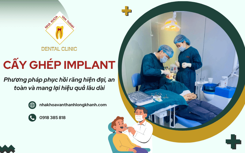 cấy ghép Implant
