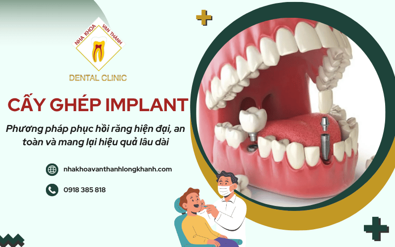 cấy ghép Implant
