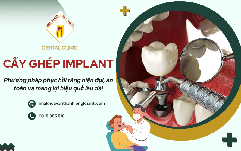 cấy ghép Implant