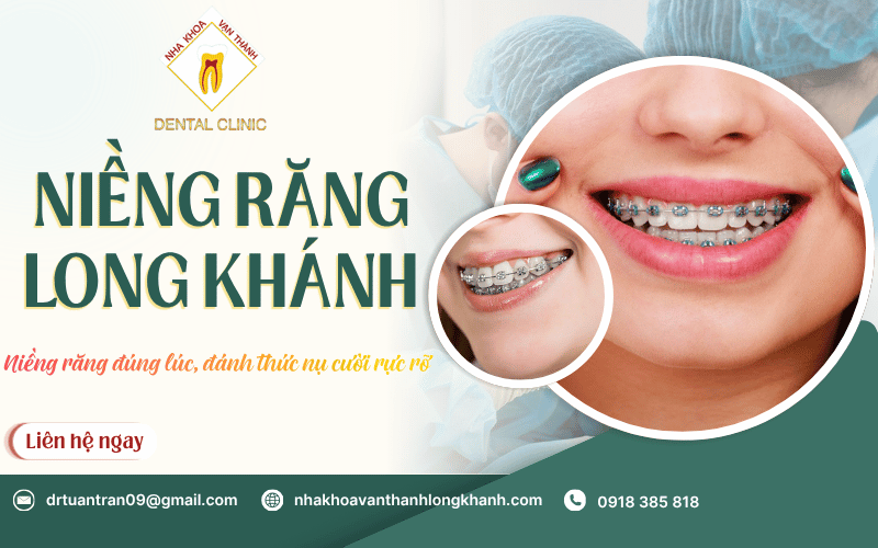 niềng răng Long Khánh