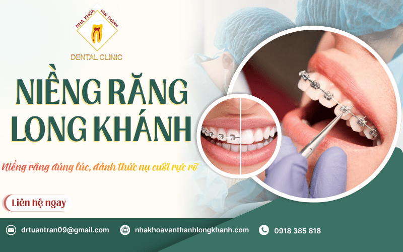 niềng răng Long Khánh