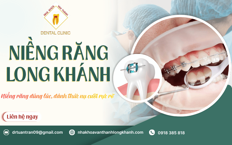 niềng răng Long Khánh