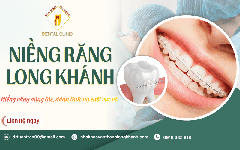 niềng răng Long Khánh