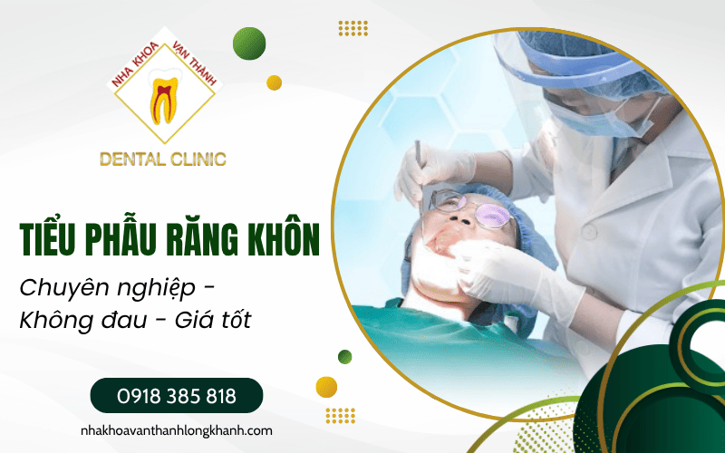 tiểu phẫu răng khôn