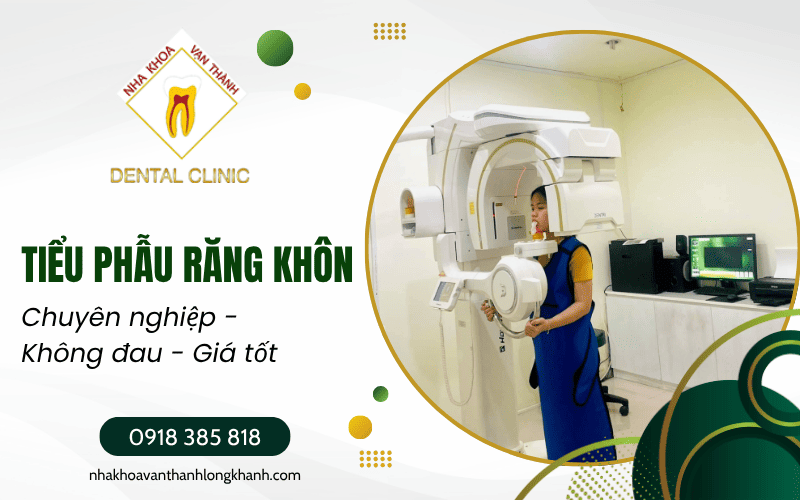 tiểu phẫu răng khôn